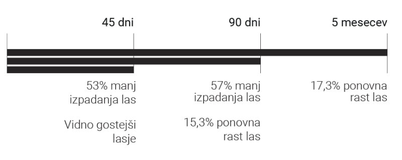 Rezultati